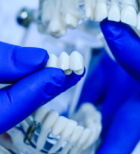 שתלים, שיקום שיניים